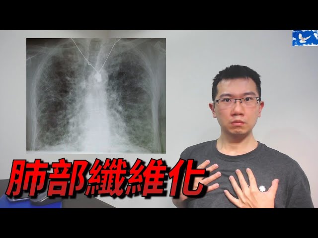 肺像菜瓜布一樣！醫還原「肺部纖維化」可怕過程：炸得坑坑疤疤