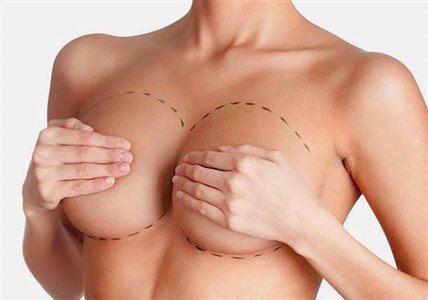 drjohndiazbreastaugmentation