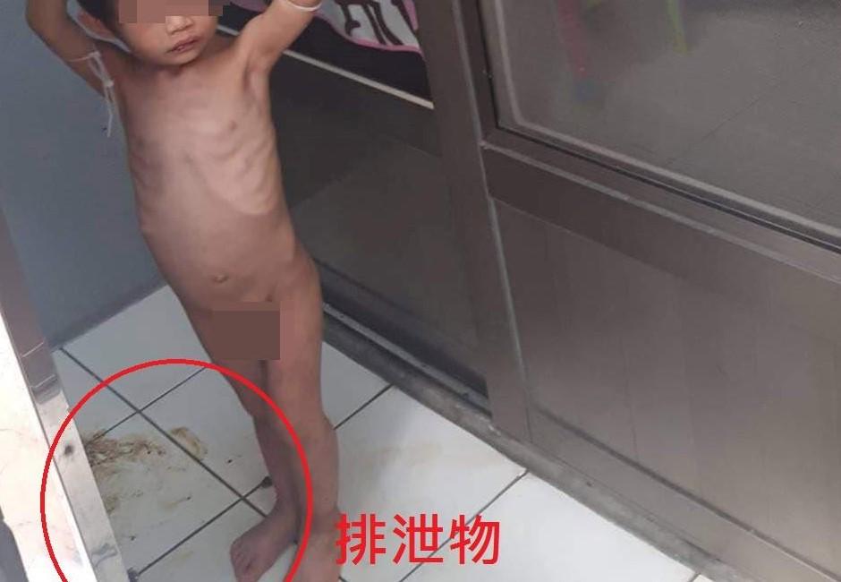 影/三歲男童被裸體吊掛在陽台餓到撿糞便吃  令人痛心